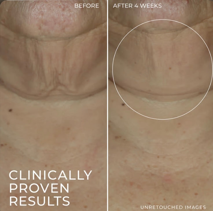 RoC Derm Correxion Firming Serum Stick image 4