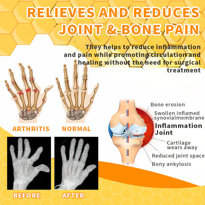 TAILEDEN™ Bee Venom Joint Therapy Pain Relief Gel image 1