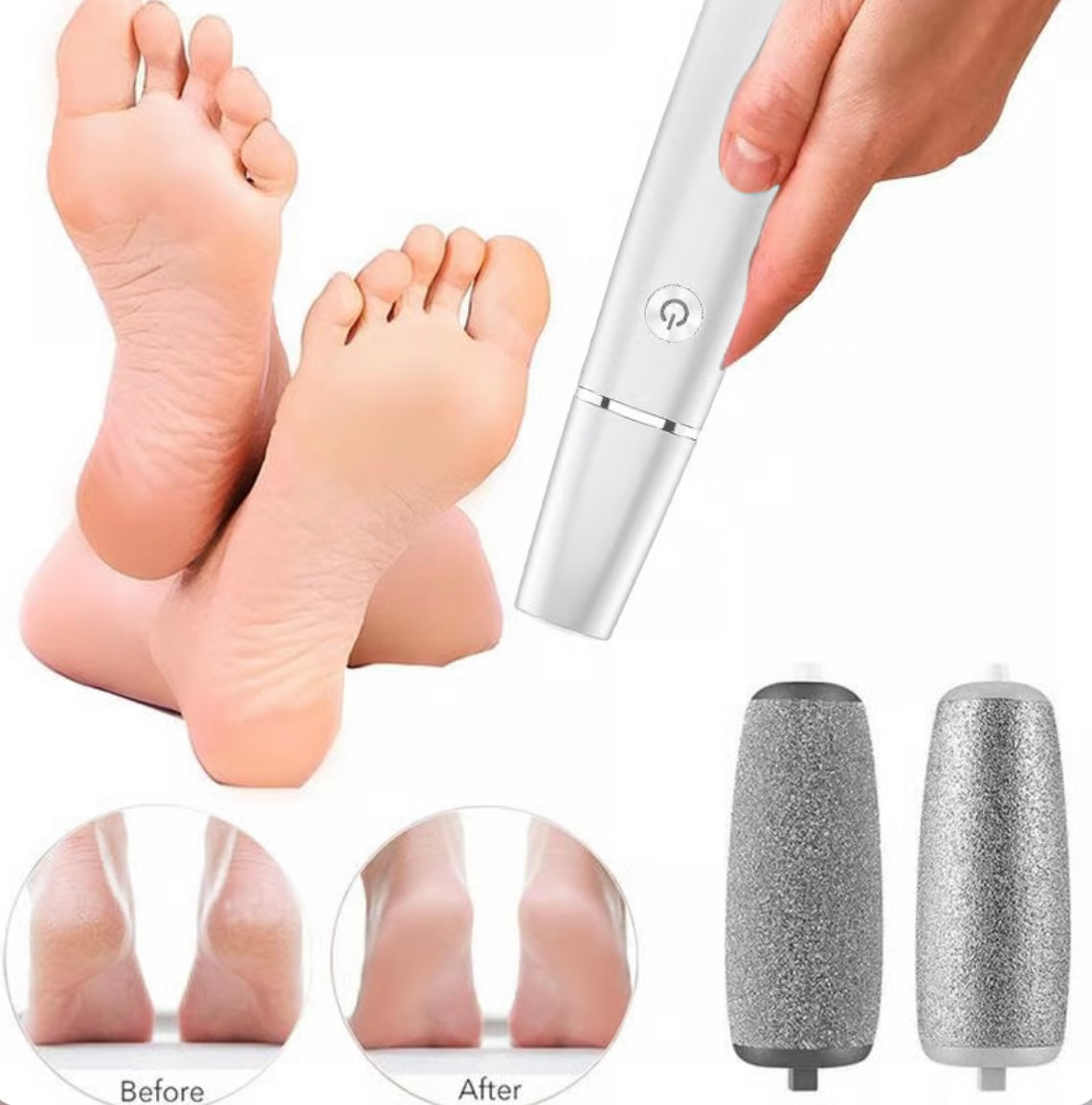 Electric Feet Callus Remover image 1