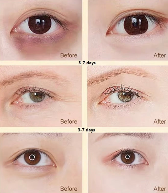 Dinkiss Lutein Eye Essence Oil image 2