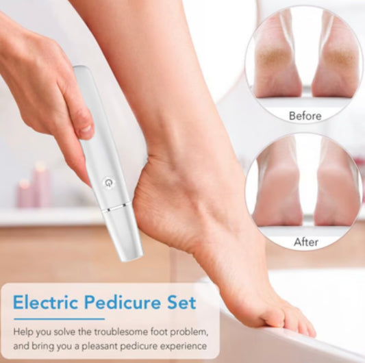 Electric Feet Callus Remover image 0