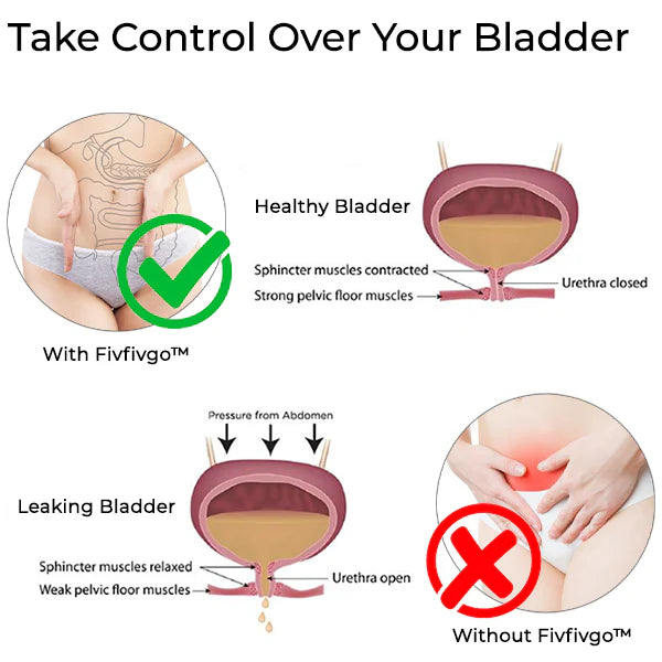 Fivfivgo™ Bladder Control Anti-Incontinence Gel image 1